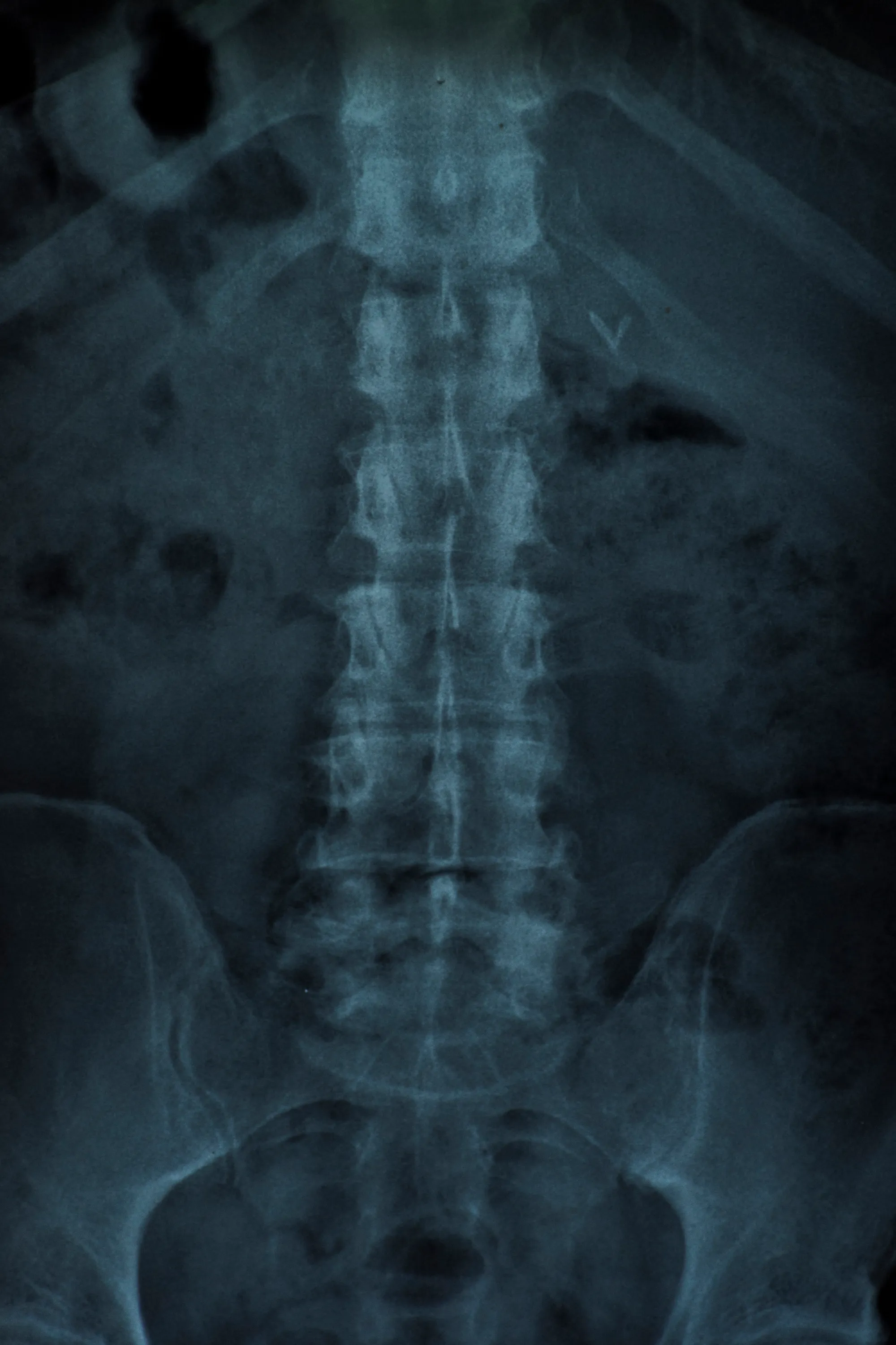 Cover for The Chiropractic Approach to Chronic Pain Management